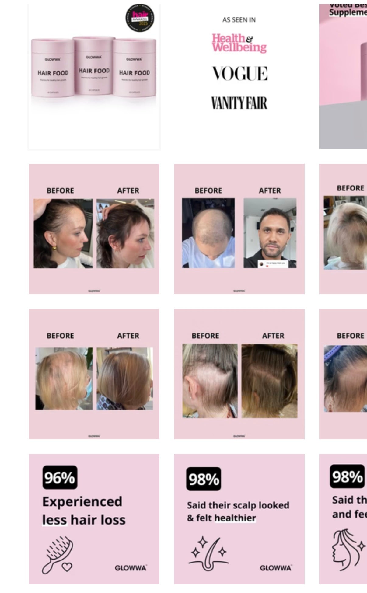 Glowwa hair supplement